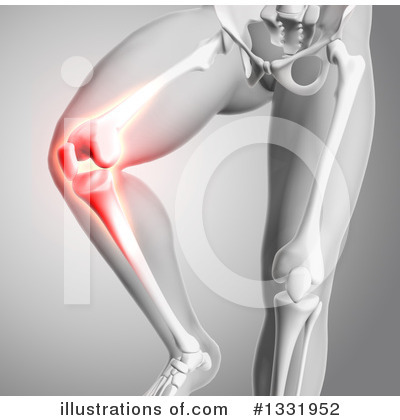 Pain Clipart #1331952 by KJ Pargeter