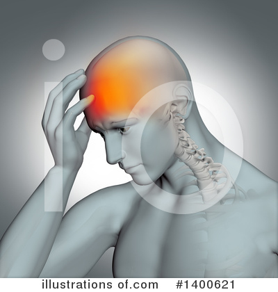 Headache Clipart #1400621 by KJ Pargeter