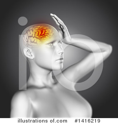 Headache Clipart #1416219 by KJ Pargeter