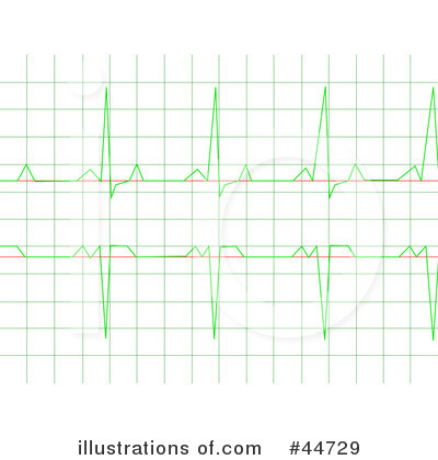 Heartbeat Clipart #44729 by oboy