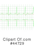 Heart Monitor Clipart #44729 by oboy
