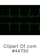 Heart Monitor Clipart #44730 by oboy
