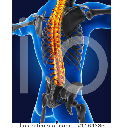 Back Pain Clipart #1169335 by KJ Pargeter