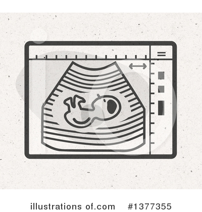 Ultrasound Clipart #1377355 by NL shop