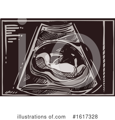 Ultrasound Clipart #1617328 by Vector Tradition SM