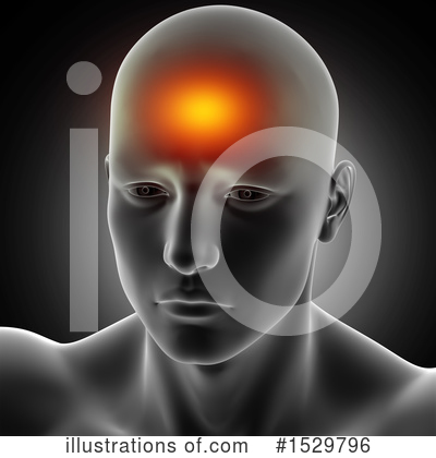 Headache Clipart #1529796 by KJ Pargeter