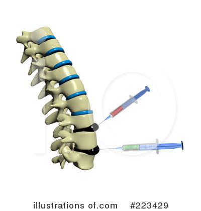 Royalty-Free (RF) Spine Clipart Illustration by Michael Schmeling - Stock Sample #223429