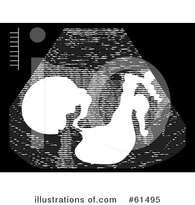 Royalty-Free (RF) Ultrasound Clipart Illustration by r formidable - Stock Sample #61495