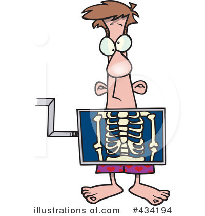Royalty-Free (RF) Xray Clipart Illustration by toonaday - Stock Sample #434194