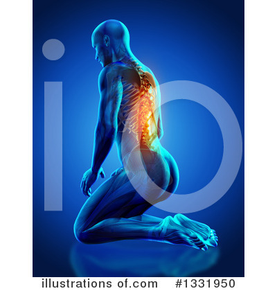 Back Pain Clipart #1331950 by KJ Pargeter