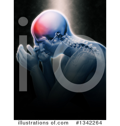 Headache Clipart #1342264 by KJ Pargeter
