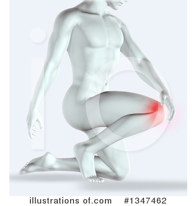 Knee Pain Clipart #1347462 by KJ Pargeter