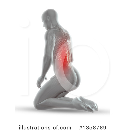 Back Pain Clipart #1358789 by KJ Pargeter