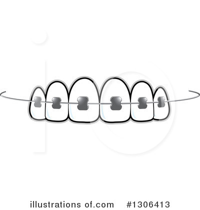 Braces Clipart #1306413 by Lal Perera