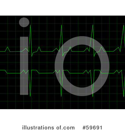 Royalty-Free (RF) Electrocardiogram Clipart Illustration by oboy - Stock Sample #59691