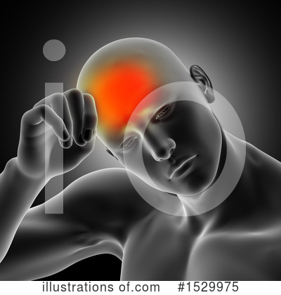 Migraine Clipart #1529975 by KJ Pargeter