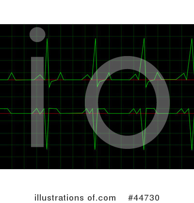 Electrocardiogram Clipart #44730 by oboy