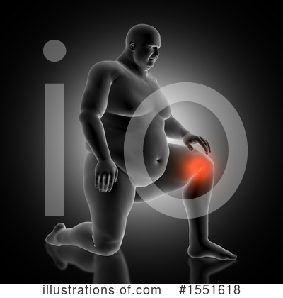 Knee Pain Clipart #1551618 by KJ Pargeter