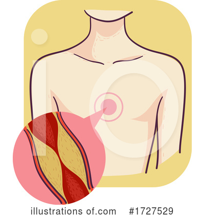 Royalty-Free (RF) Medical Clipart Illustration by BNP Design Studio - Stock Sample #1727529