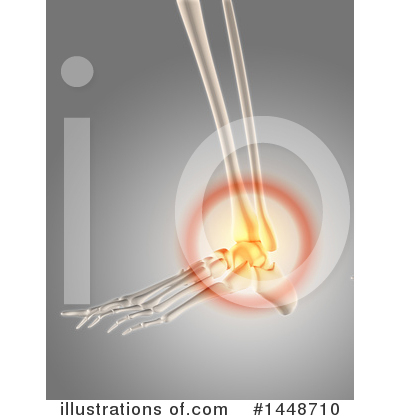 Royalty-Free (RF) Pain Clipart Illustration by KJ Pargeter - Stock Sample #1448710
