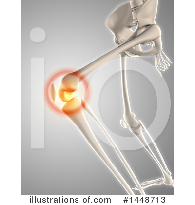 Knee Pain Clipart #1448713 by KJ Pargeter