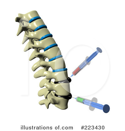 Royalty-Free (RF) Spine Clipart Illustration by Michael Schmeling - Stock Sample #223430