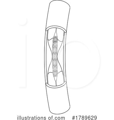 Royalty-Free (RF) Stent Clipart Illustration by Lal Perera - Stock Sample #1789629