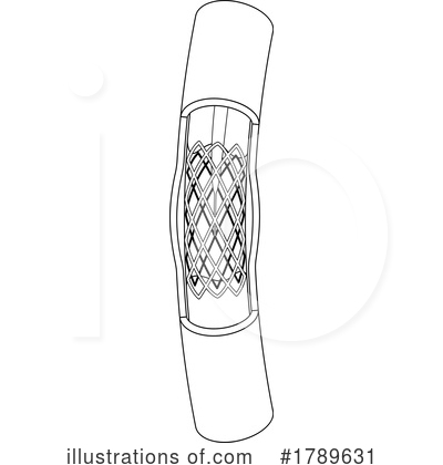 Royalty-Free (RF) Stent Clipart Illustration by Lal Perera - Stock Sample #1789631
