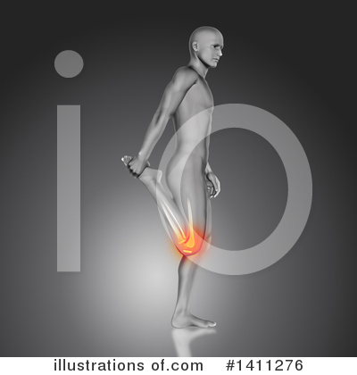 Knee Pain Clipart #1411276 by KJ Pargeter